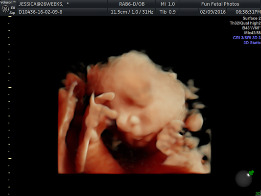 Fun Fetal Photos 3D Ultrasound prenatal imaging