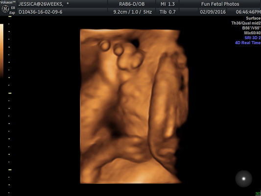 Fun Fetal Photos 3D Ultrasound prenatal imaging