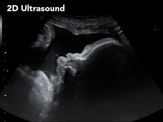 2D Ultrasound