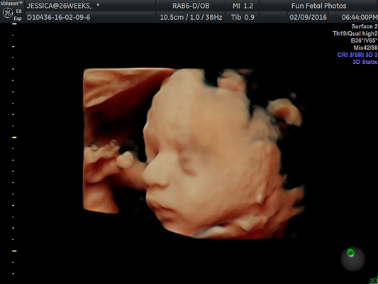 Fun Fetal Photos 2D Ultrasound prenatal imaging